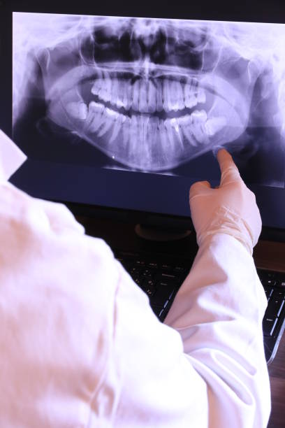 Best Emergency Wisdom Teeth Removal in North Auburn, CA