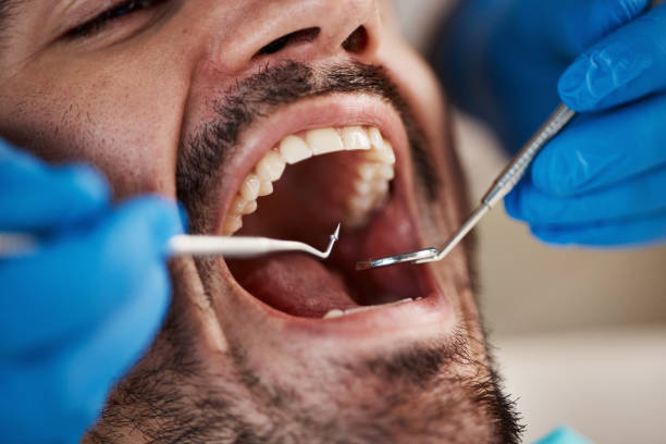 Best Pediatric Emergency Dentist in North Auburn, CA