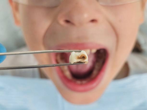 Best Emergency Orthodontic Repairs in North Auburn, CA